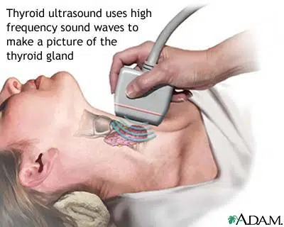 thyroid ultrasound.jpg
